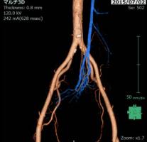 CTの画像