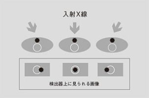 マンモグラフィの画像