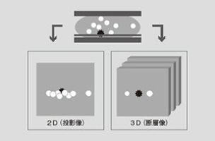 マンモグラフィの画像