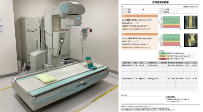 骨密度測定装置の画像