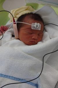 新生児聴覚スクリーニング検査